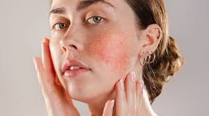 Skin Problems